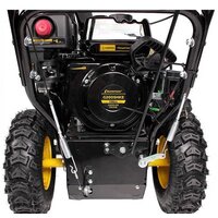 Champion ST662E Image #5